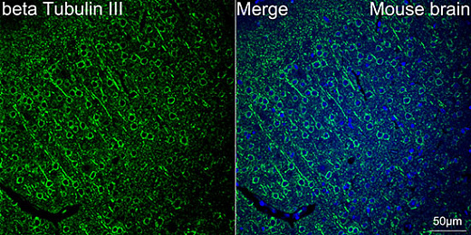 Антитела Anti-Rabbit IgG (H+L) козьи, поликлональные, коньюгированые с ABflo 408, конфокальная визуализация мозга мыши