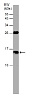 Вестерн-блот анализ плазмы крови человека  Антитела Anti-Cystatin C antibody (ab226841) в разведении 1: 1000 + 30 мкг плазмы крови; Прогнозируемый размер белка: 16 кДа; Гель: 15% полиакриламидный гель с ДСН.