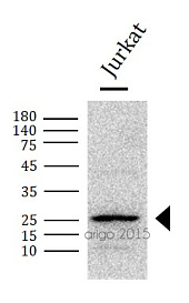 Вестерн-блоттинг: 30 мкг лизата клеток Jurkat, окрашенного антителами anti-Bcl 2 antibody в разведении 1:1000.