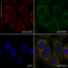 Антитела Recombinant Anti-Glypican 1/ GPC1, 100 мкл, Abcam