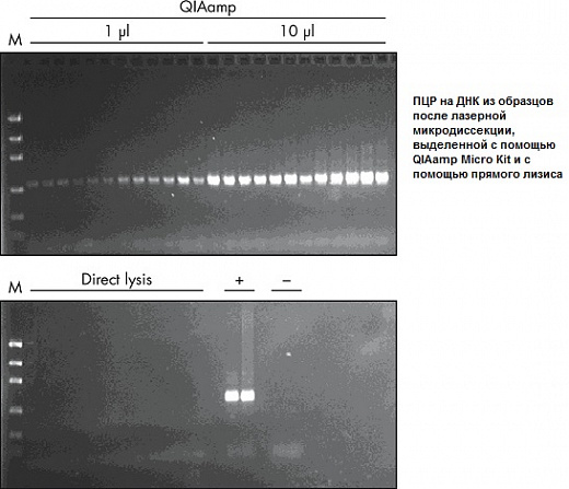 Набор для выделения ДНК из биологических образцов малого объёма QIAamp DNA Miсro Kit